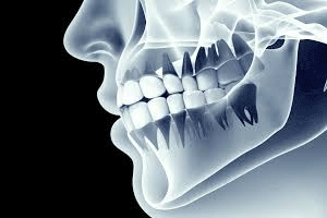 Healthy Gums, Strong Bones: The Unexpected Connection